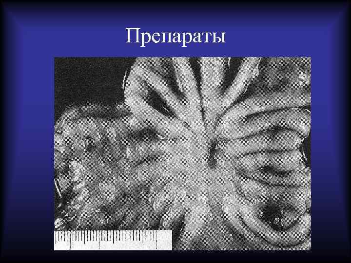 Препараты 