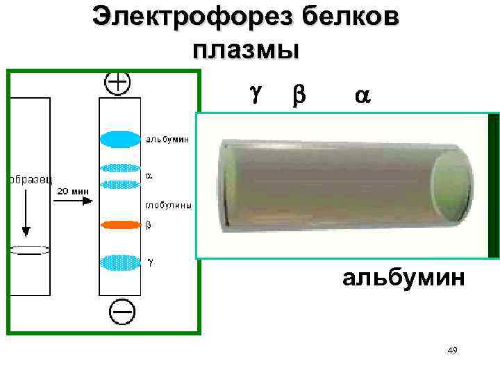 Электрофорез белков плазмы альбумин 49 