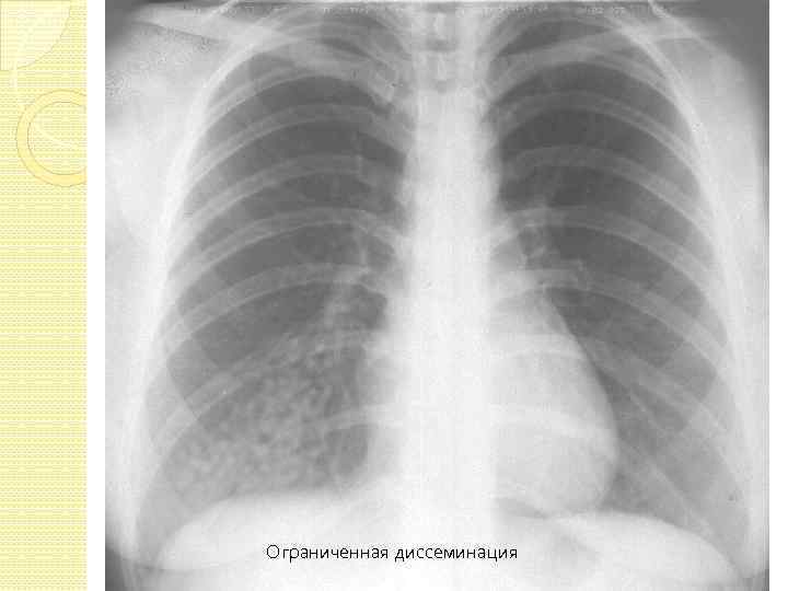 Ограниченная диссеминация 
