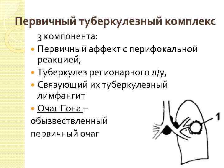 Первичный туберкулезный комплекс 3 компонента: Первичный аффект с перифокальной реакцией, Туберкулез регионарного л/у, Связующий