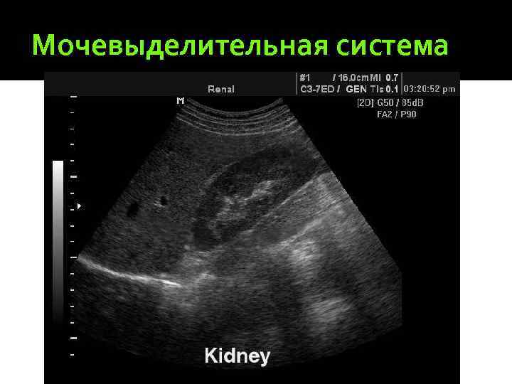 Мочевыделительная система 