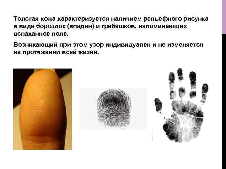 Толстая кожа характеризуется наличием рельефного рисунка в виде бороздок (впадин) и гребешков, напоминающих вспаханное