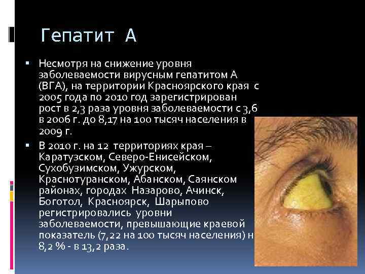 Гепатит А Несмотря на снижение уровня заболеваемости вирусным гепатитом А (ВГА), на территории Красноярского