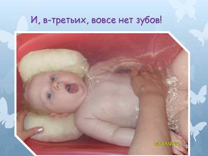 И, в-третьих, вовсе нет зубов! 