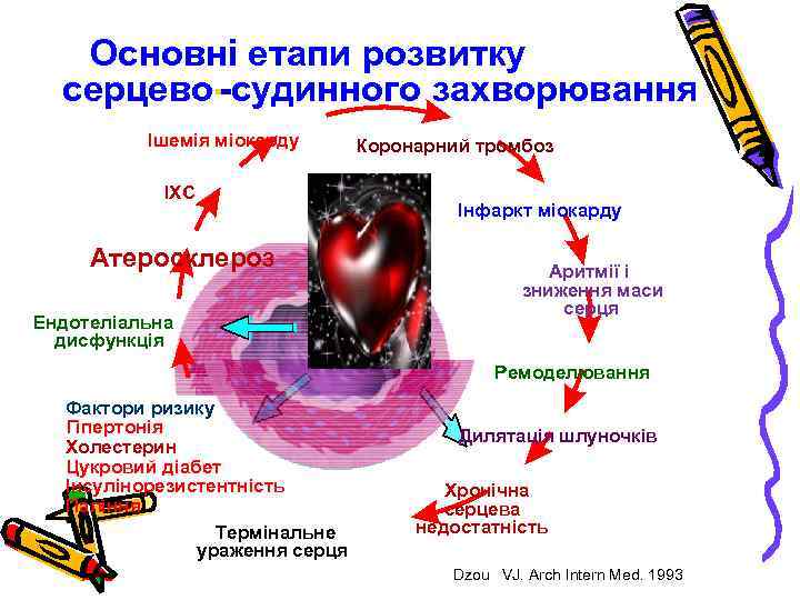 Основні етапи розвитку серцево--судинного захворювання Ішемія міокарду ІХС Атеросклероз Ендотеліальна дисфункція Коронарний тромбоз Інфаркт