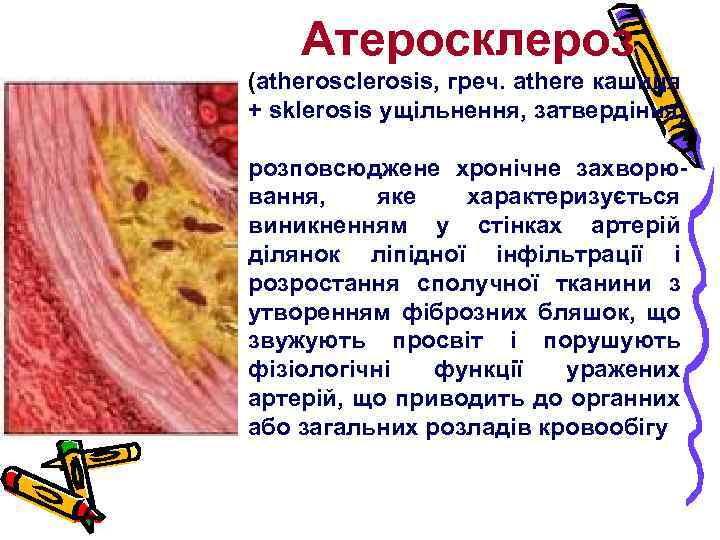 Атеросклероз (atherosclerosis, греч. athere кашиця + sklerosis ущільнення, затвердіння) розповсюджене хронічне захворювання, яке характеризується
