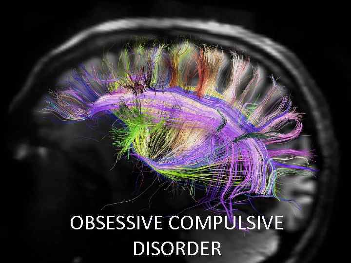 OBSESSIVE COMPULSIVE DISORDER 