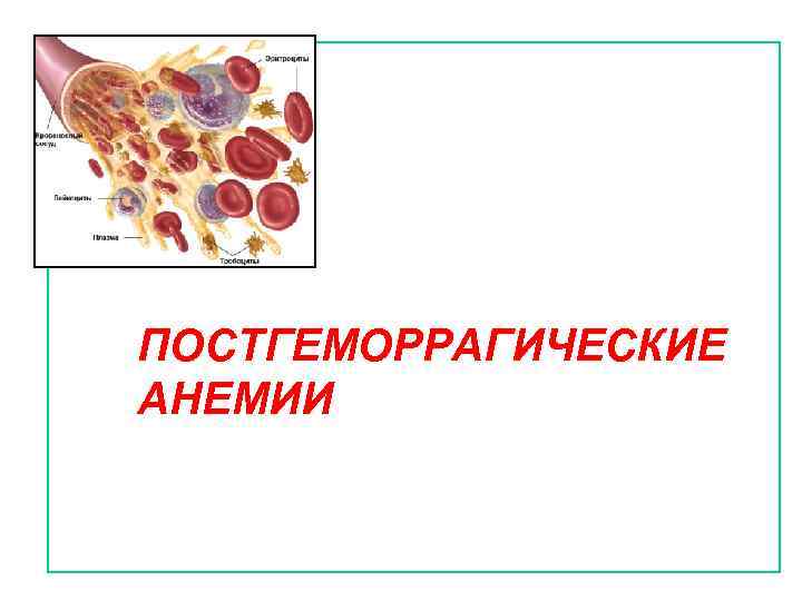 Острая постгеморрагическая анемия этиология патогенез картина крови