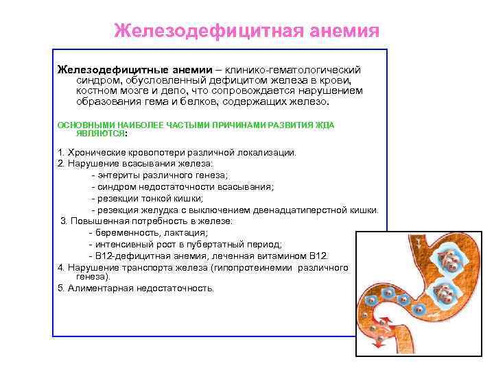 Обусловленный отсутствием железа латынь. Железодефицитная анемия лекция. Жда лекция.