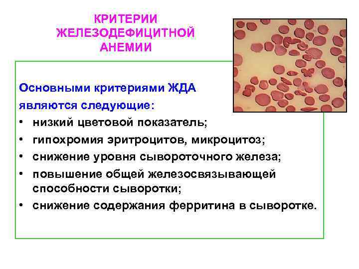 Микроцитарная анемия это