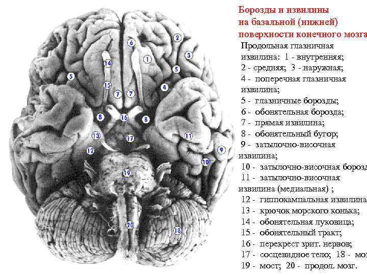 Борозды и извилины на базальной (нижней) поверхности конечного мозга Продольная глазничная извилина: 1 -