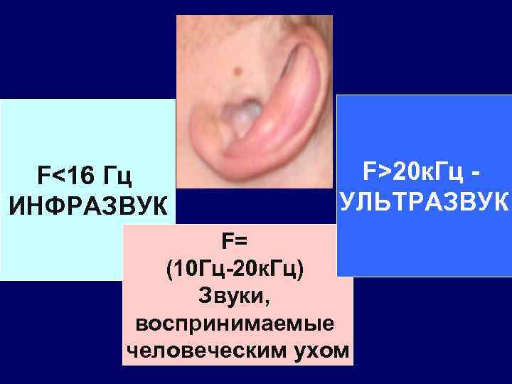 F<16 Гц ИНФРАЗВУК F>20 к. Гц УЛЬТРАЗВУК F= (10 Гц-20 к. Гц) Звуки, воспринимаемые