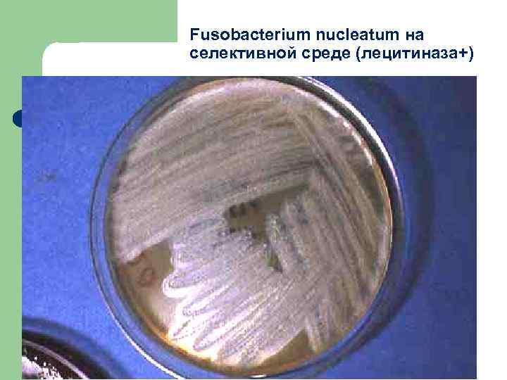 Fusobacterium nucleatum на селективной среде (лецитиназа+) 