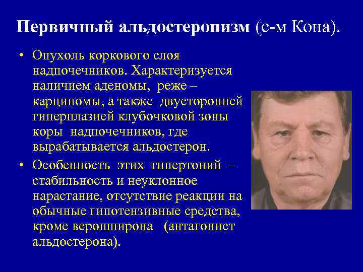 Первичный альдостеронизм (с-м Кона). • Опухоль коркового слоя надпочечников. Характеризуется наличием аденомы, реже –