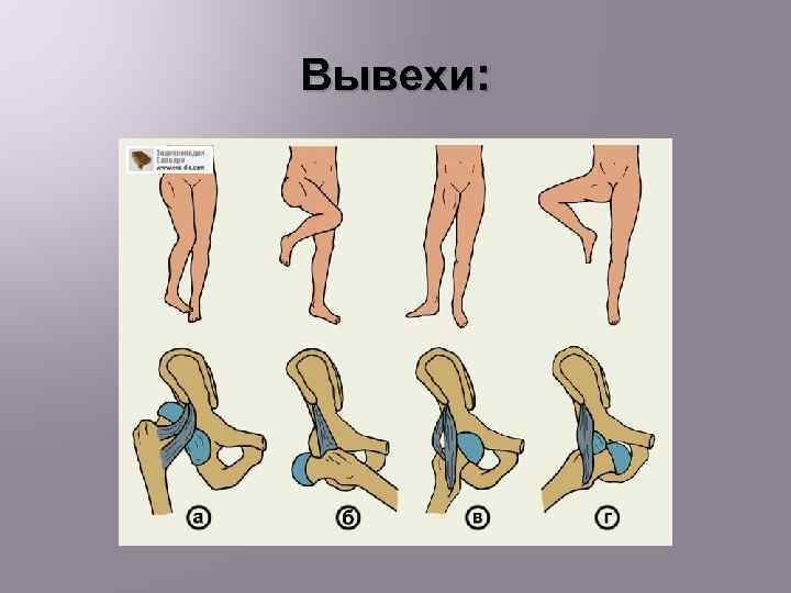 Вывехи: 