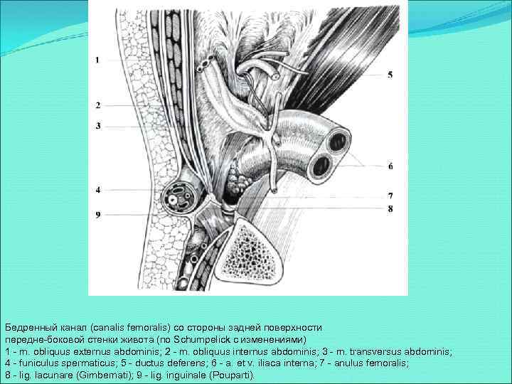 Бедренный канал (canalis femoralis) со стороны задней поверхности передне-боковой стенки живота (по Schumpelick с