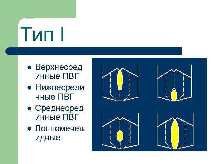 Тип I l l Верхнесред инные ПВГ Нижнесреди нные ПВГ Среднесред инные ПВГ Лонномечев