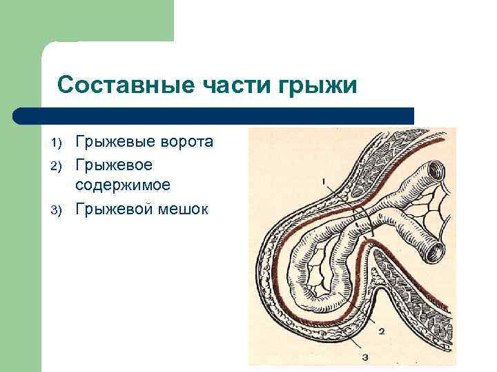 Грыжевые ворота