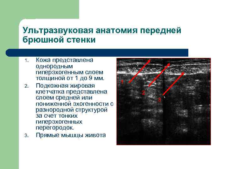 Ультразвуковая анатомия передней брюшной стенки 1. 2. 3. Кожа представлена однородным гиперэхогенным слоем толщиной