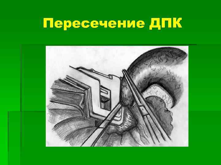 Пересечение ДПК 