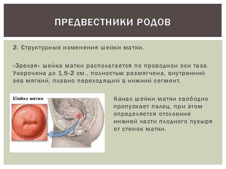 ПРЕДВЕСТНИКИ РОДОВ 2. Структурные изменения шейки матки. «Зрелая» шейка матки располагается по проводной оси