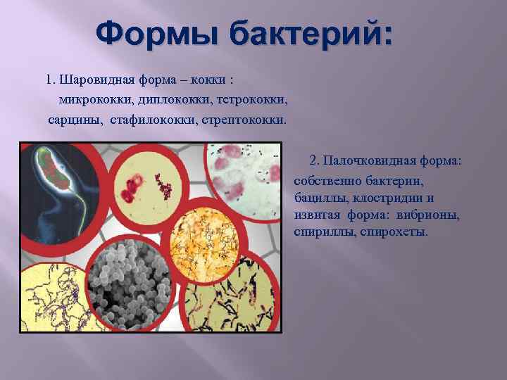 Формы бактерий: 1. Шаровидная форма – кокки : микрококки, диплококки, тетрококки, сарцины, стафилококки, стрептококки.