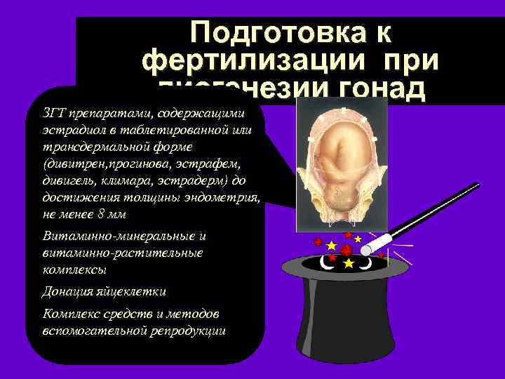 Подготовка к фертилизации при дисгенезии гонад ЗГТ препаратами, содержащими эстрадиол в таблетированной или трансдермальной