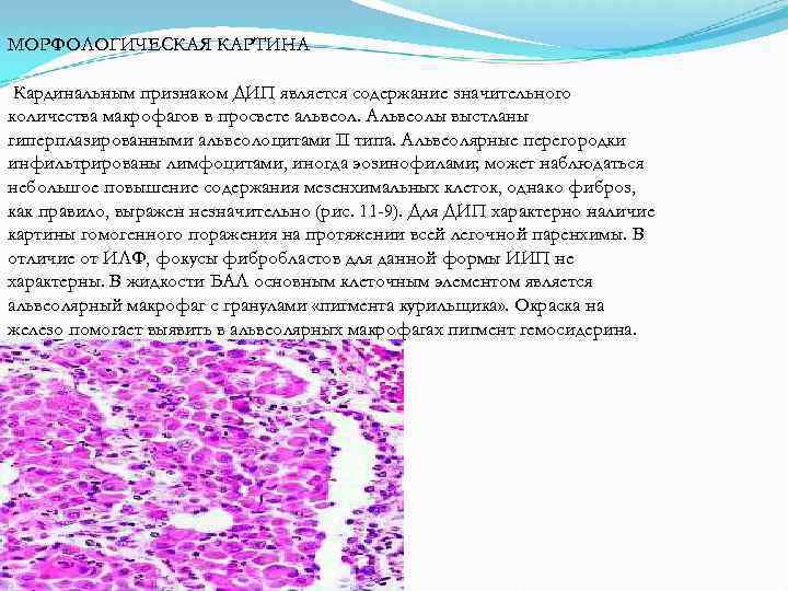 Макроскопическая картина легкого при фиброзирующих альвеолитах