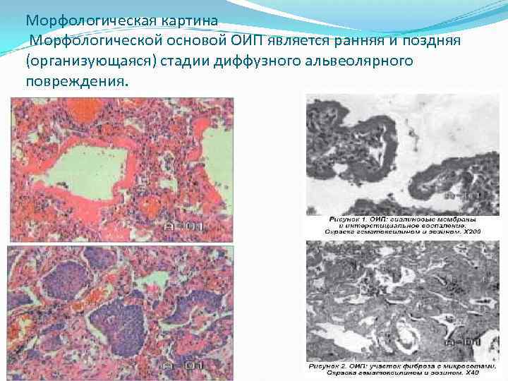 Морфологическая картина это такое в медицине