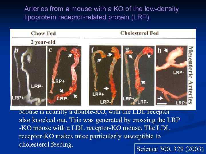 Arteries from a mouse with a KO of the low-density lipoprotein receptor-related protein (LRP).