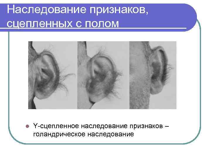 Наследование признаков, сцепленных с полом l Y-сцепленное наследование признаков – голандрическое наследование 