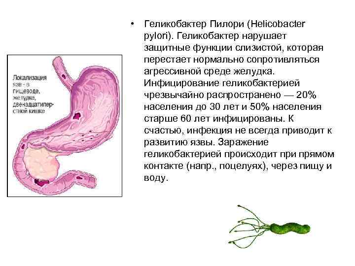  • Геликобактер Пилори (Helicobacter pylori). Геликобактер нарушает защитные функции слизистой, которая перестает нормально