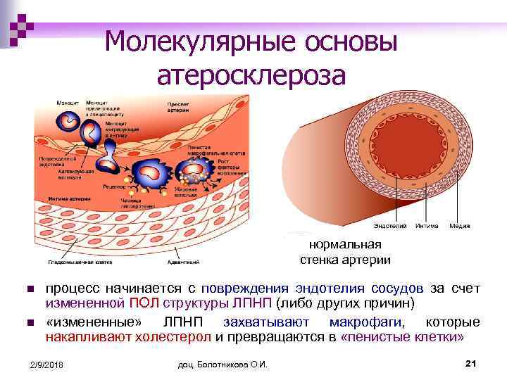 Молекулярные основы атеросклероза нормальная стенка артерии n n процесс начинается с повреждения эндотелия сосудов