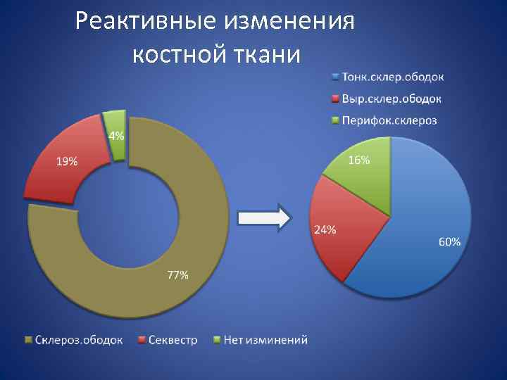 Реактивные изменения костной ткани 