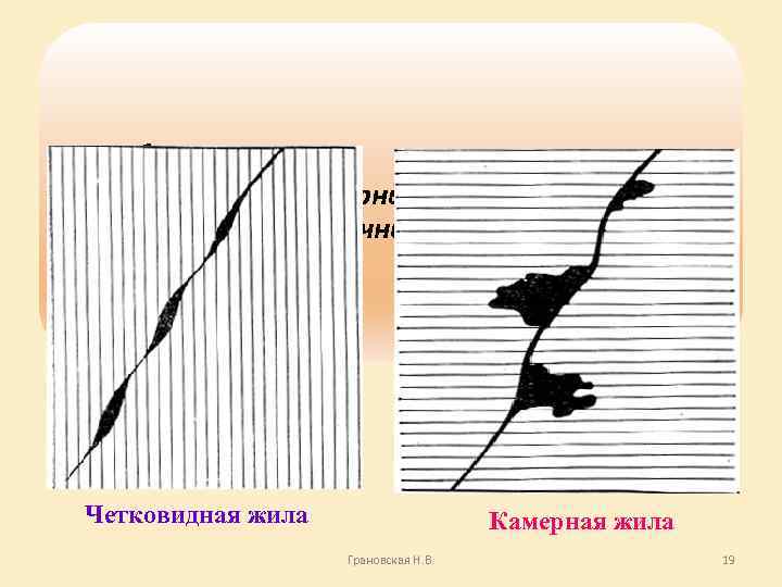 Жилы бывают четковидными, камерными, седловидными, оперяющими, лестничными Четковидная жила Камерная жила Грановская Н. В.