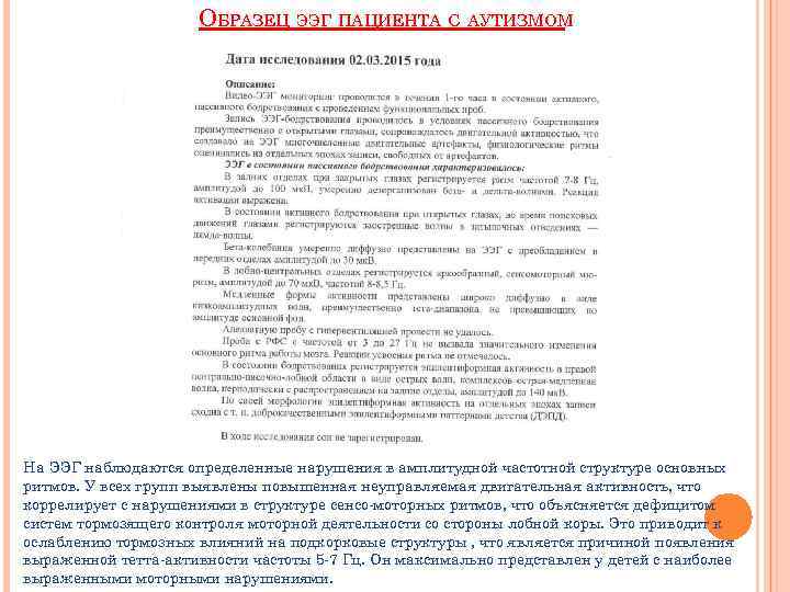 ОБРАЗЕЦ ЭЭГ ПАЦИЕНТА С АУТИЗМОМ На ЭЭГ наблюдаются определенные нарушения в амплитудной частотной структуре