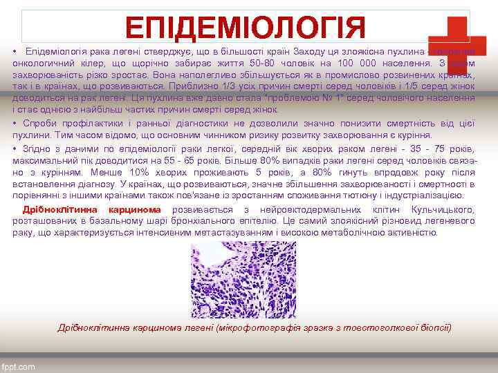 ЕПІДЕМІОЛОГІЯ • Епідеміологія рака легені стверджує, що в більшості країн Заходу ця злоякісна пухлина