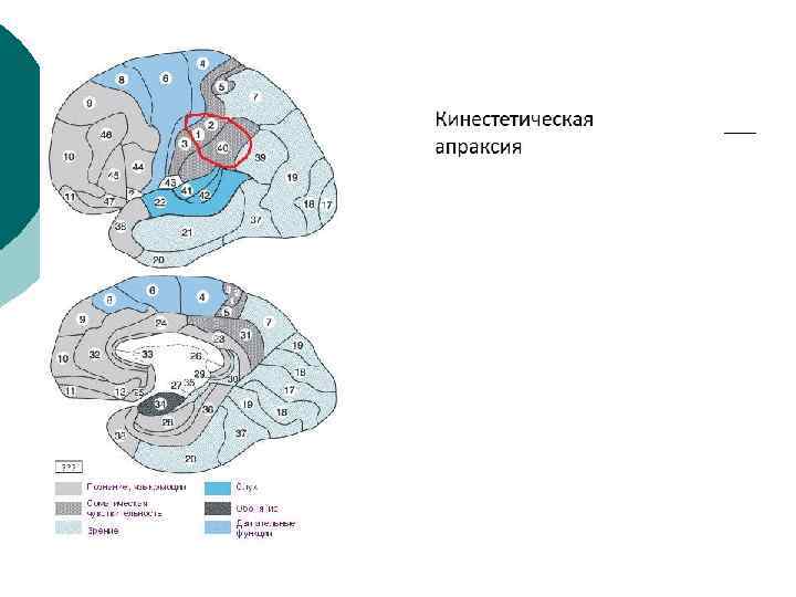 Кинестетическая апраксия фото