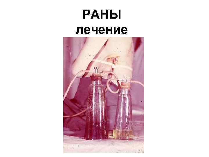 РАНЫ лечение 