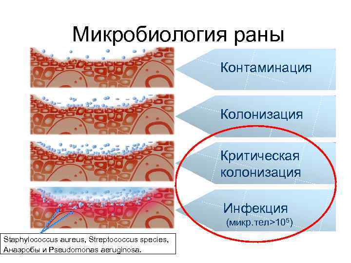 Микробиология раны Контаминация Колонизация Критическая колонизация Инфекция (микр. тел>105) Staphylococcus aureus, Streptococcus species, Анаэробы