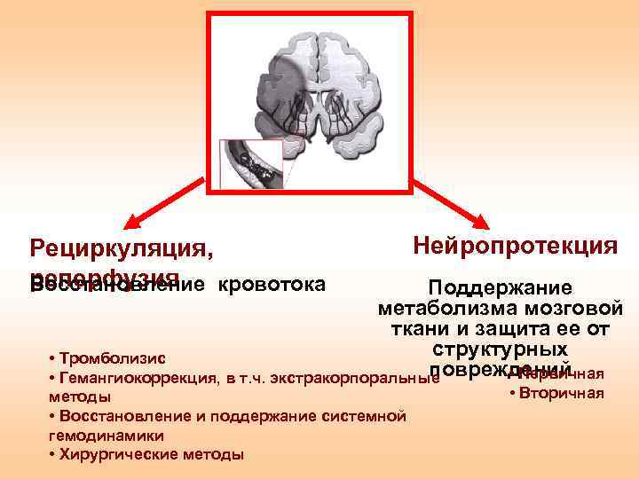 Острые нарушения мозгового кровообращения презентация