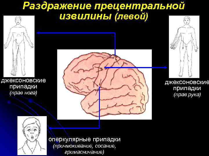 Раздражение коры головного мозга