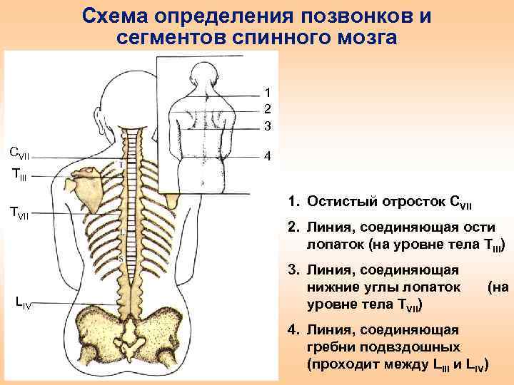 Поясница схема