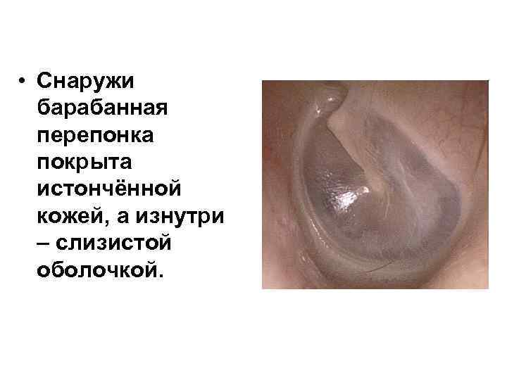  • Снаружи барабанная перепонка покрыта истончённой кожей, а изнутри – слизистой оболочкой. 
