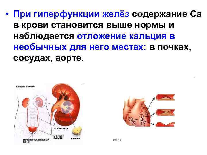  • При гиперфункции желёз содержание Са в крови становится выше нормы и наблюдается