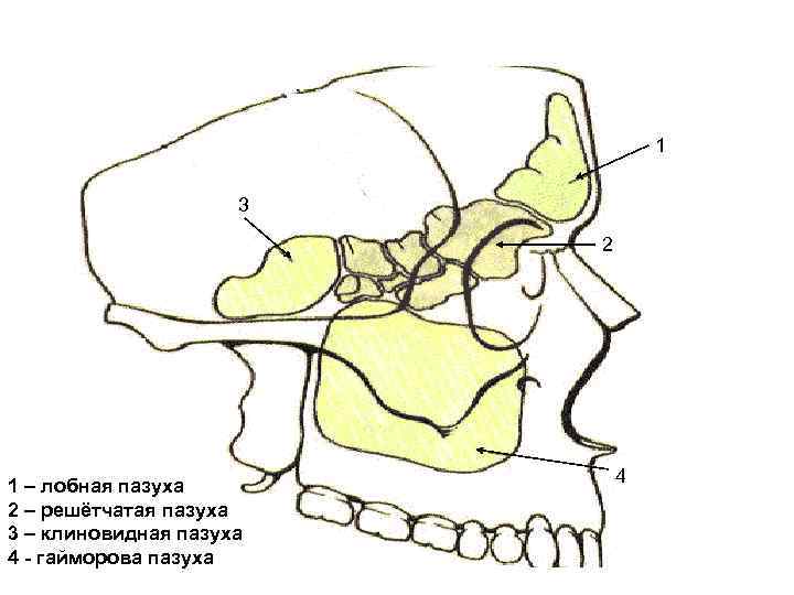 1 3 2 1 – лобная пазуха 2 – решётчатая пазуха 3 – клиновидная