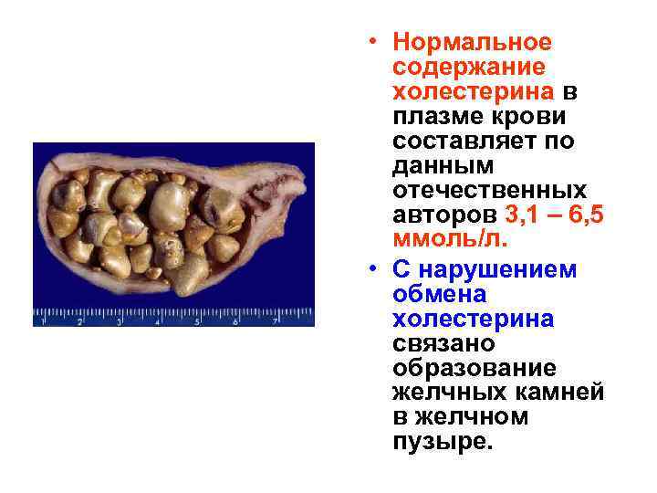  • Нормальное содержание холестерина в плазме крови составляет по данным отечественных авторов 3,