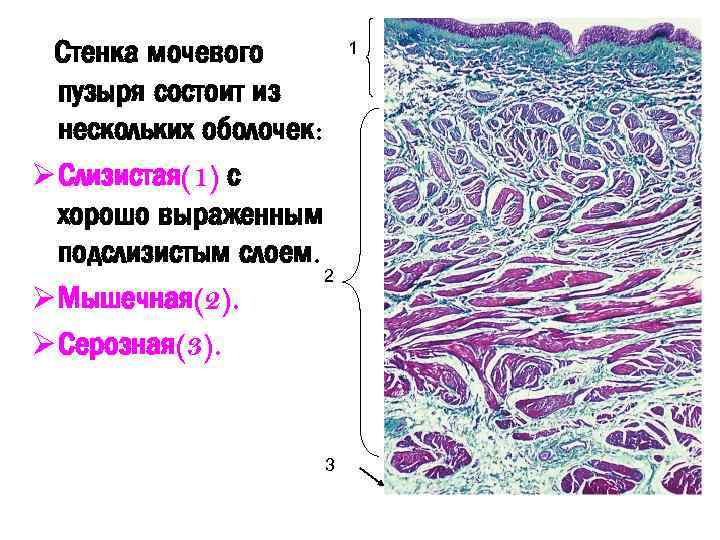 Стенка мочевого