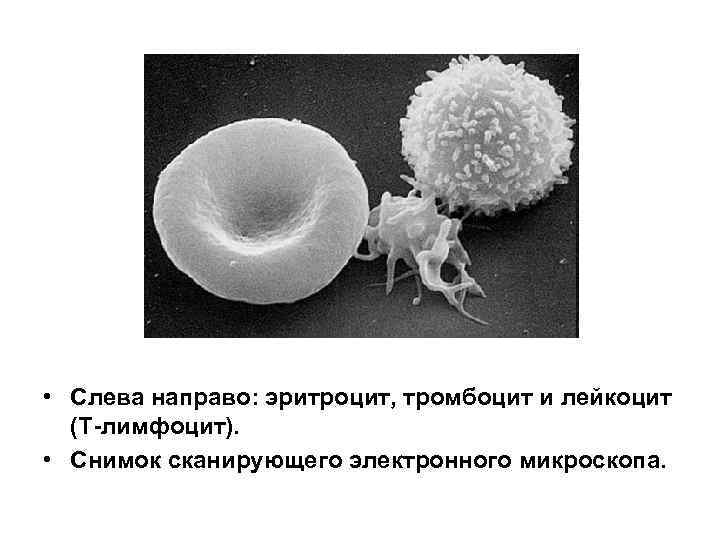  • Слева направо: эритроцит, тромбоцит и лейкоцит (T-лимфоцит). • Снимок сканирующего электронного микроскопа.