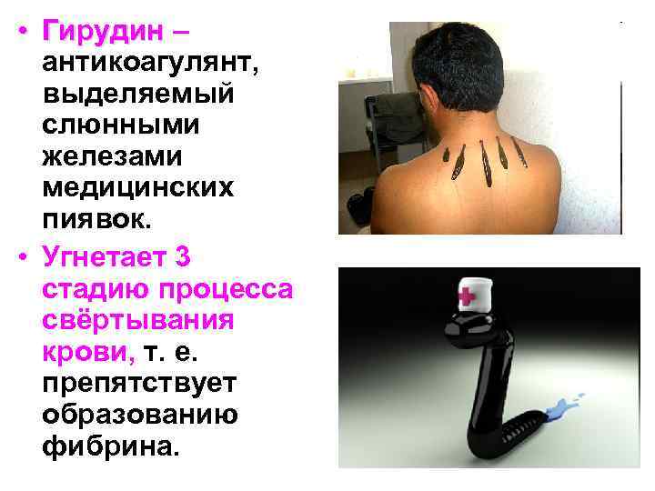  • Гирудин – антикоагулянт, выделяемый слюнными железами медицинских пиявок. • Угнетает 3 стадию
